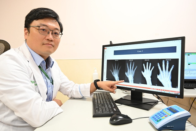 廚師患類風濕關節炎誤認「不會痛就沒事」  醫提醒:無聲無息破壞中