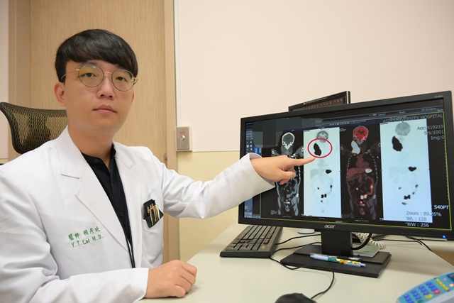 老翁頸部長出「鴕鳥蛋」壓迫氣管險致命  竟是伯基特淋巴瘤惹的禍