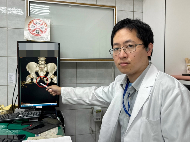 遭重擊!失血1/3、骨盆爆、腸外露    醫師鬼門關前救人