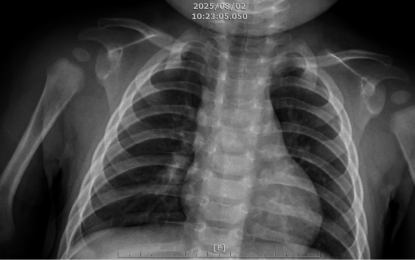 嬰染大魔王肺炎「有打疫苗有保庇」