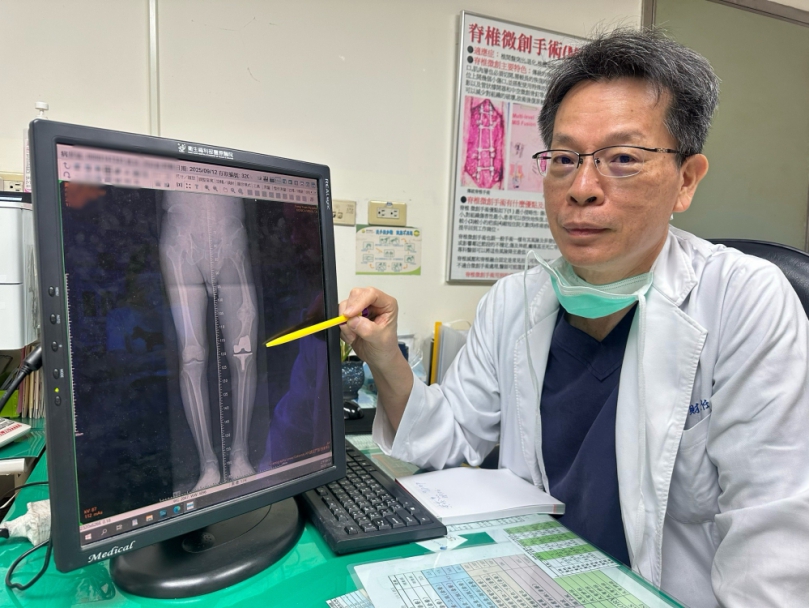 7公分長短腳再見！豐原87歲翁一跛數十年　靠精準關節手術重獲新步伐