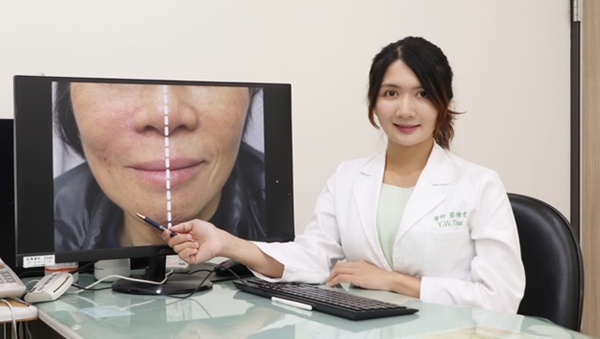 中年女臉部皺紋顯疲態    皮膚科醫師教你破解歲月痕跡