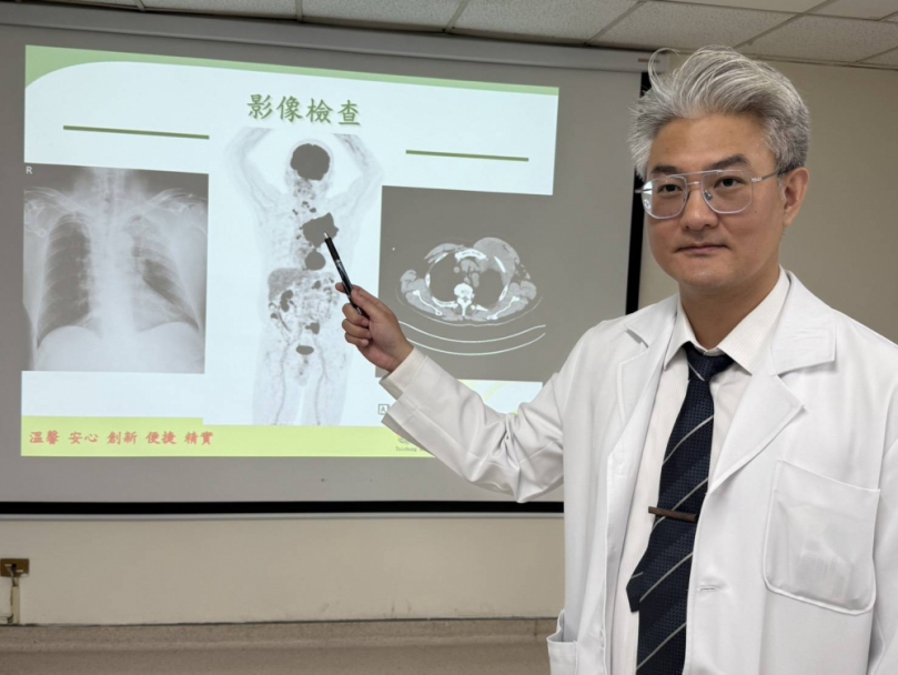 胸部長出14公分腫瘤 70歲企業主罹伯基特式淋巴癌 標靶化療後腫瘤幾近消失