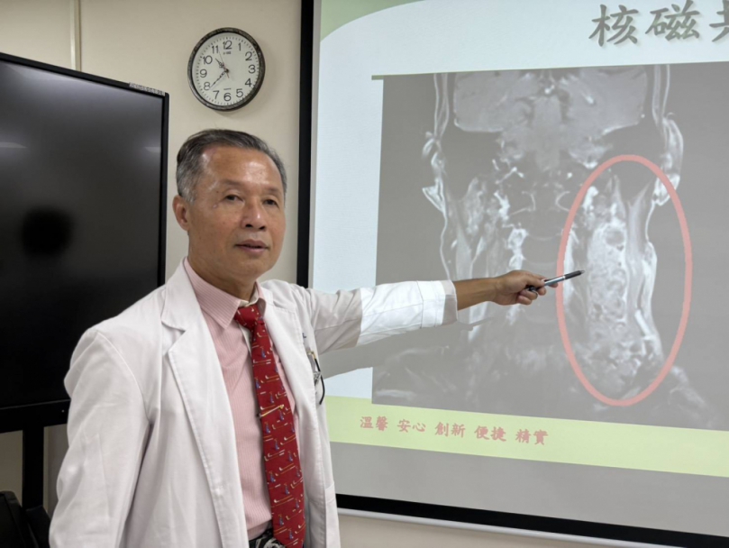 臺中男子頸部腫塊就醫 竟發現頸部巨大腫瘤