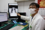 30多歲男移工抽菸又在粉塵場所工作  來台3年健檢查出罹患肺癌